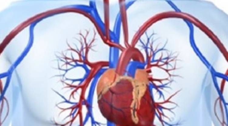 علاج الجلطة القلبيّة