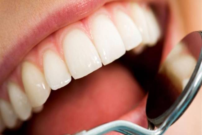 أسباب ومخاطر تسوس الأسنان
