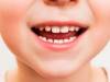 ظهور الأسنان عند الأطفال